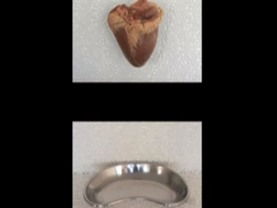 Corazón Tejido – 2007