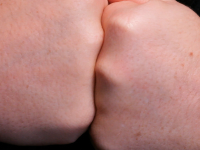 Um corpo – duas partes – 2013