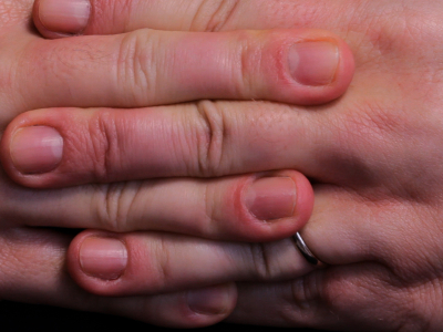 Um corpo – duas partes – 2013